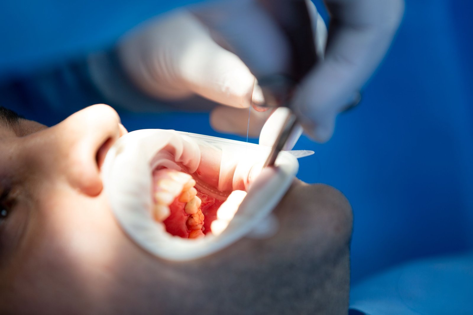 Malpositioned Teeth Specialist