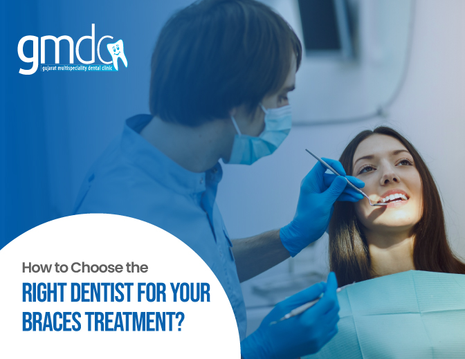Braces Treatment