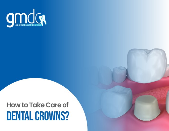 Dental Crowns